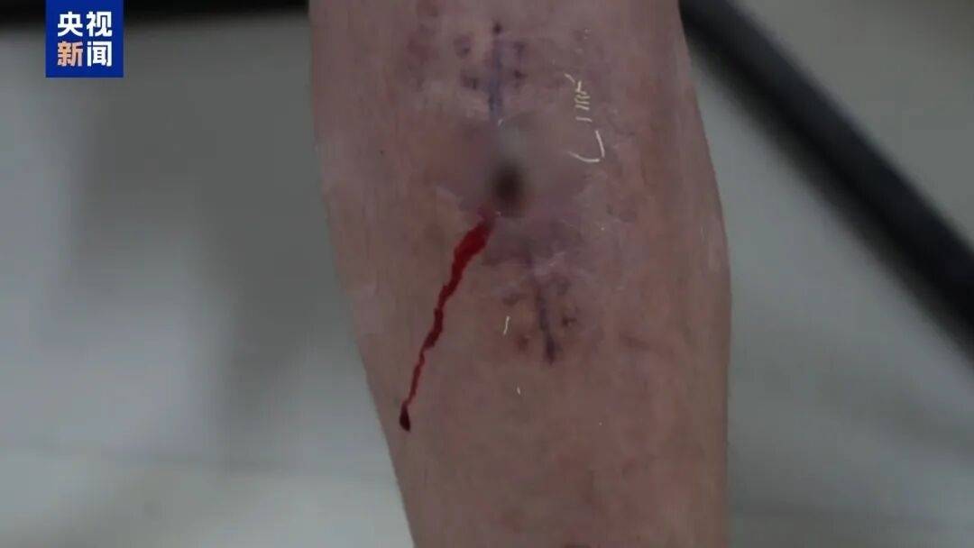 一个中国人卖30多万,接班人和金主结拜杀人祭天……缅北果敢魏家犯罪集团专案细节曝光