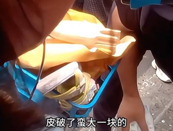 看着都疼!上海街头一男子突然求助:10岁女儿被死死卡住!这个行为太危险→
